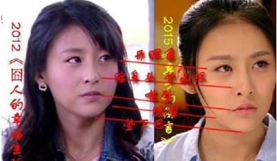 賈青整容了嗎？賈青整容前後照片對比 賈青青澀照片大匯集