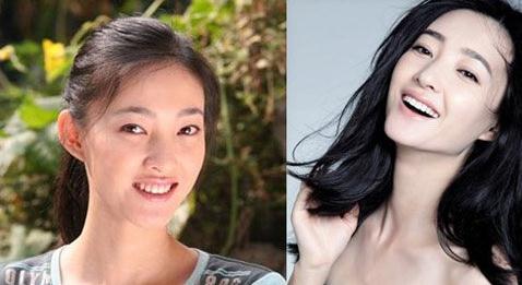 王麗坤整容了嗎？王麗坤整容照片對比照