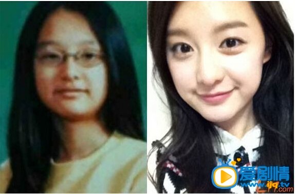 金智媛個人資料簡介 金智媛整容前後對比照