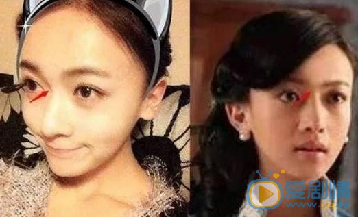 吳謹言整容了嗎？吳謹言整容前後照片對比