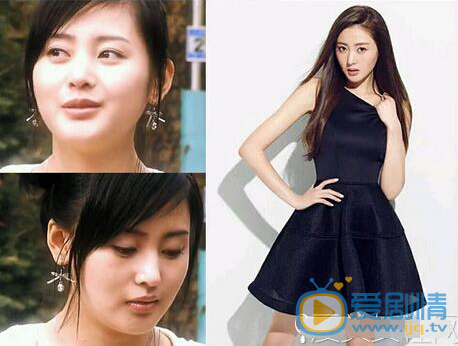 張天愛整容了嗎？張天愛成名前照片曝光